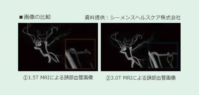 特長イメージ：MRI画像