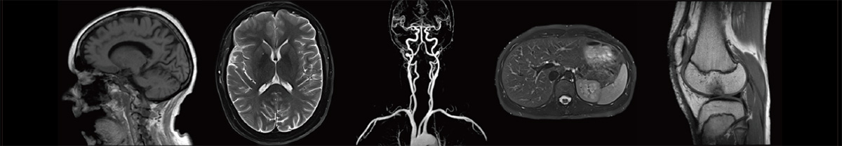 MRI撮像イメージ
